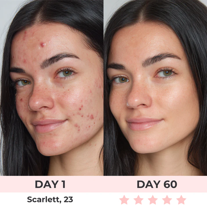 7-in-1 LED Facial Sculptor