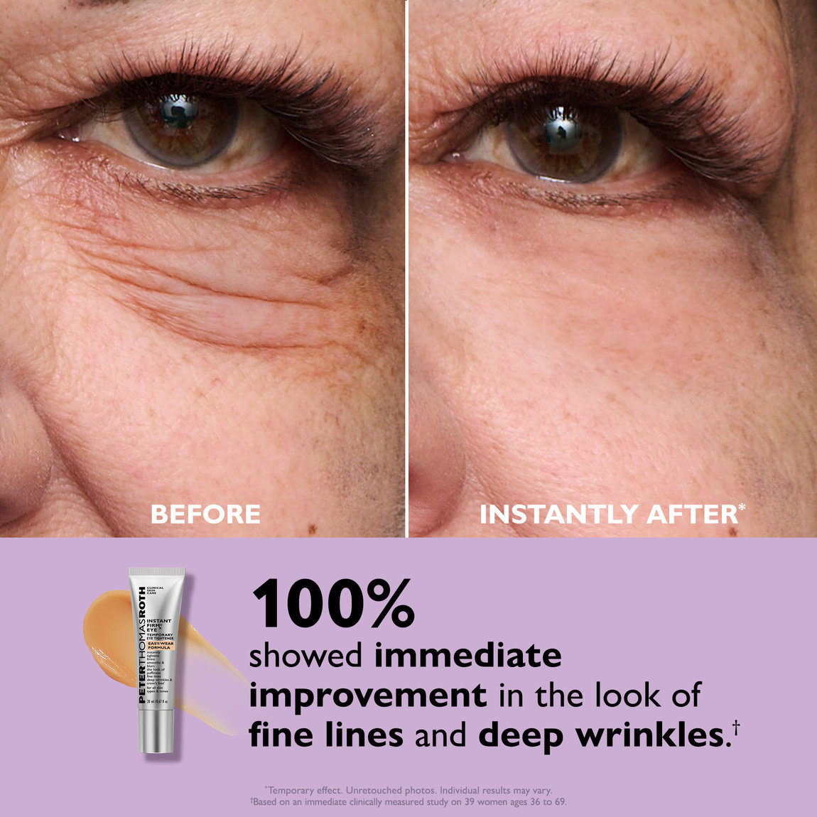 Instant Under Eye Bag Remover