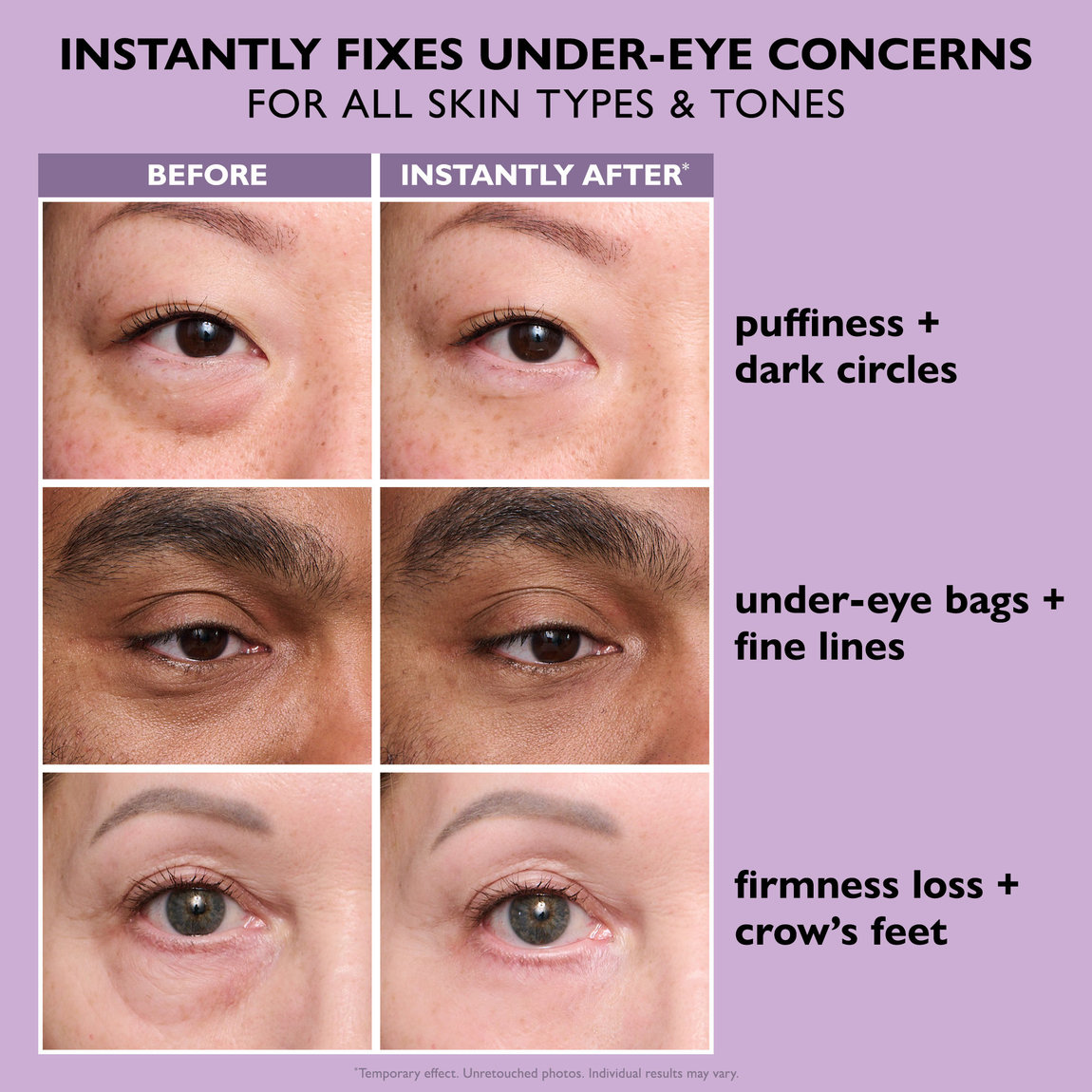 Instant Under Eye Bag Remover